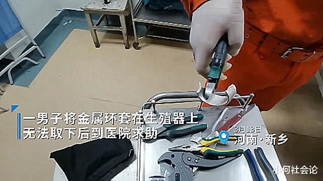 小何社会论 河南一男子将金属环套下体被卡，医生束手无策，消防员：尽力而为