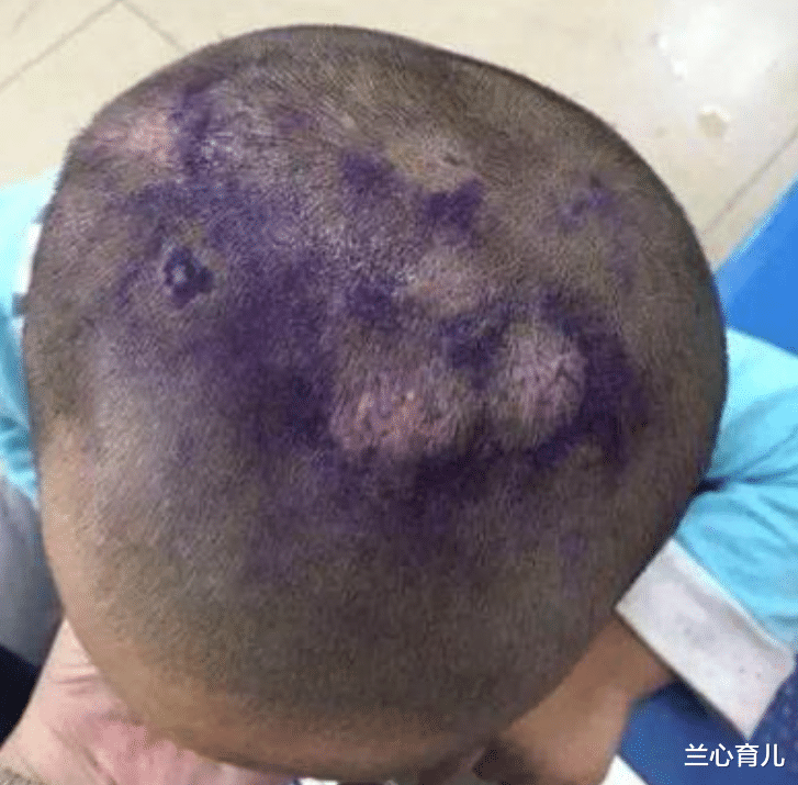 兰心育儿|4岁孙子睡觉总捂着头，奶奶半夜扒开头发，忍不住掉下眼泪