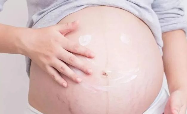 秀尚青依|孕晚期是胎宝宝“猛长期”,也是妊娠纹高发期,宝妈要学会预防