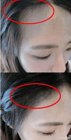 妇科疾病|曝光列入黑名单的“致癌”洗发水，专家提醒：家里有的赶紧丢了！