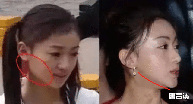 朱芊佩|那些削骨“一刀切”的明星还好吗？有的已垮掉，小方脸成最后赢家