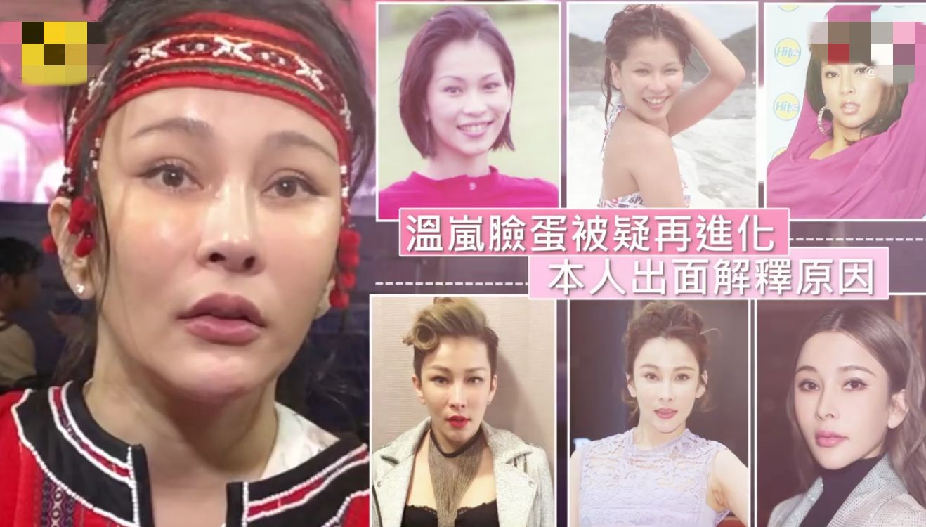 温岚|42岁温岚身体走样似大妈，满脸全是科技感，网友：怎么整成这样了