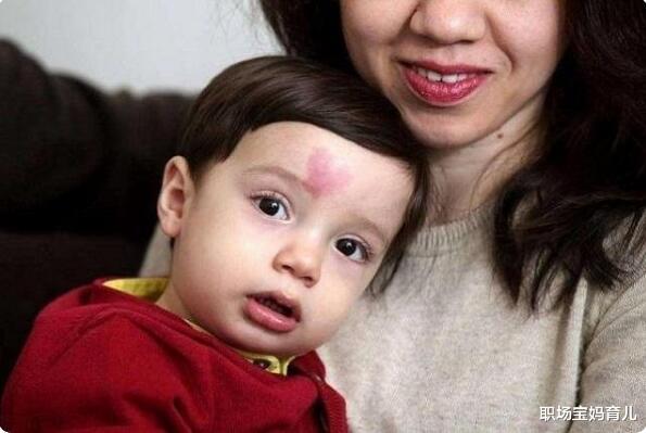 职场宝妈育儿|产科医生：想要孩子出生没胎记，孕期坚持“3不要”，以免娃自卑