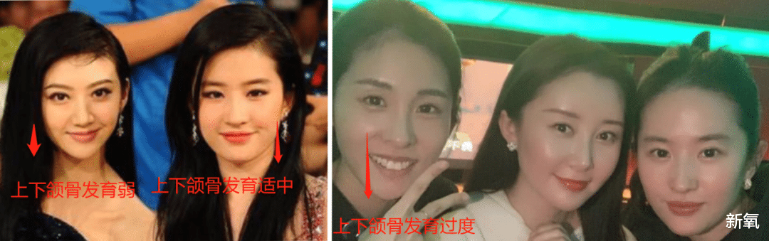 宋祖儿|撞脸天宝的北影第一美，颜值吊打室友宋祖儿，侧脸却一言难尽…