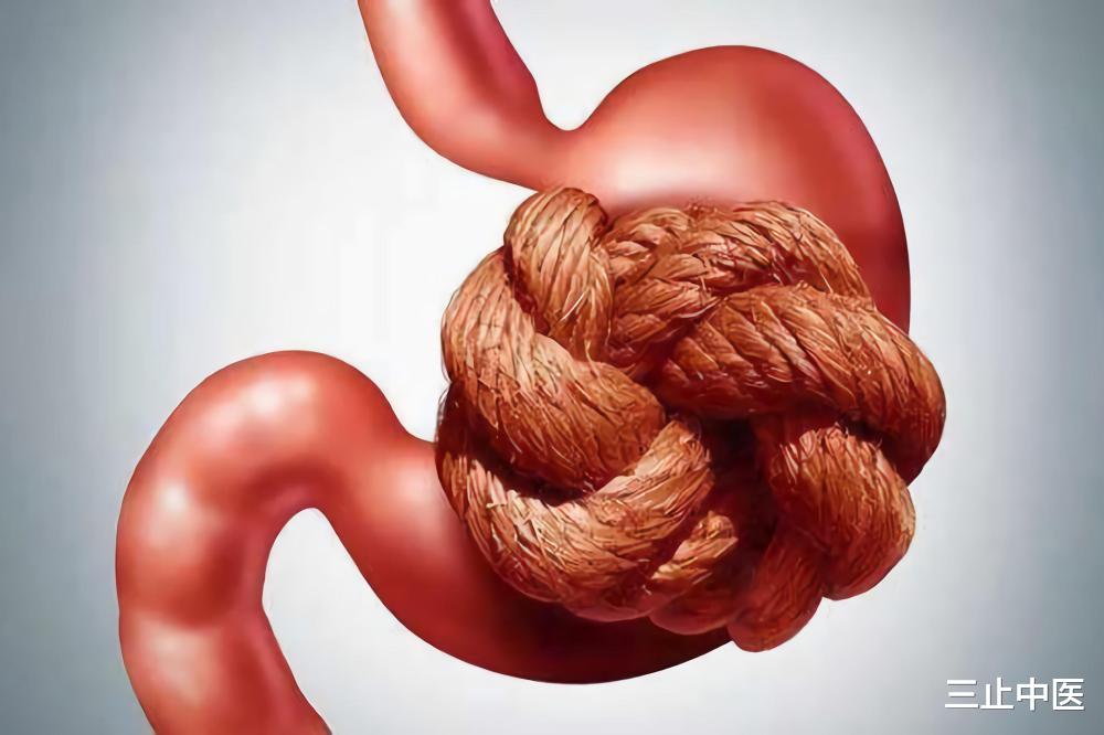 胃病|这种胃病光吃胃药没用，必须得治“肝”