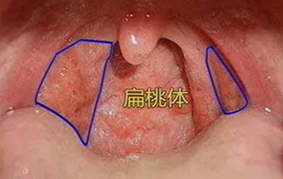 朱医生讲健康 世界卫生组织声明：要是不想得癌症，这8个报警信号一定要知道
