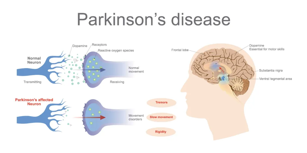 神经元 Science子刊：来自水果的化合物，有望逆转帕金森病