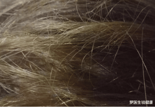 罗医生说健康|21岁大学生，甲状腺癌手术后，3个月复发，医生：“1水”是祸首