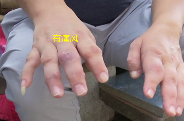 四叶草海之恋|因老公不能过夫妻生活,妻子大吐不快闹离婚,男子:先把礼金退了