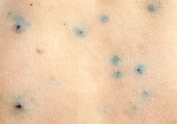 |脚部若出现4种情况，当心体内癌细胞已“藏不住”，及时就医