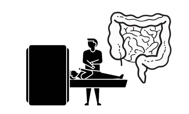 体检|50岁过后，体检若不查这2项，得了癌症都不知道，早了解！