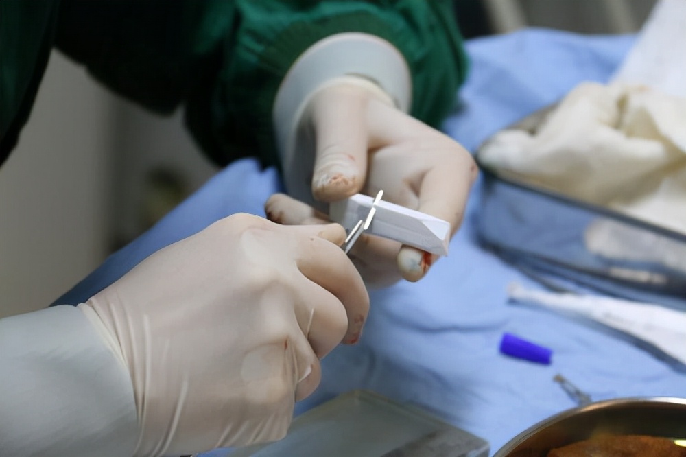 整容|这个女人疯狂整容35年，把自己整残废了还要继续整，这样子真美吗？