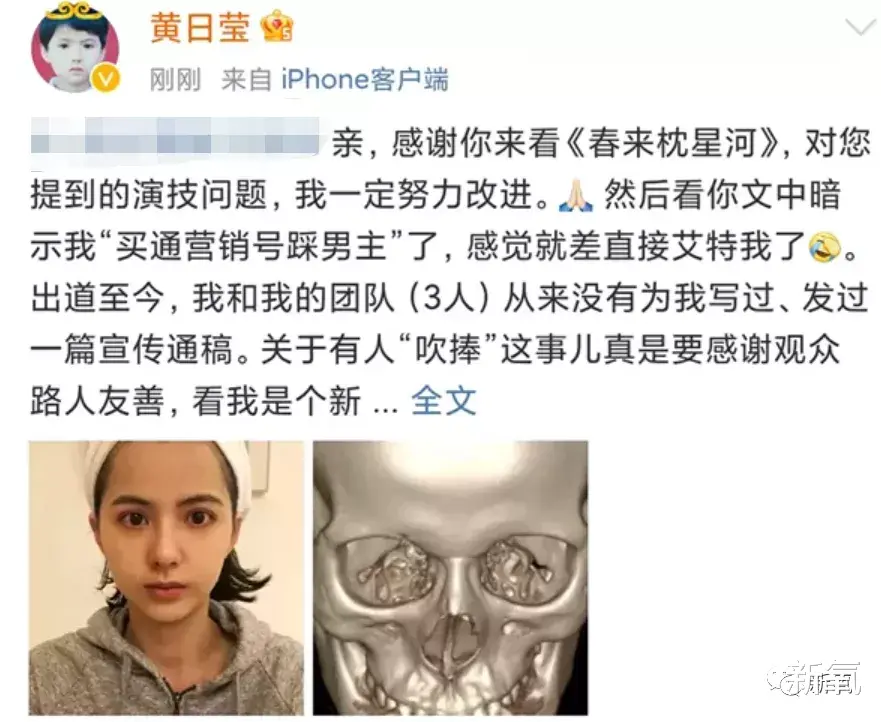 刘璇|堪比杨超越的新晋建模脸，才出道就敢网暴素人？