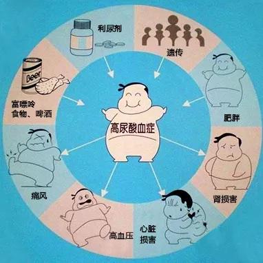 痛风|痛风患者减肥，对降尿酸防痛风有帮助吗？
