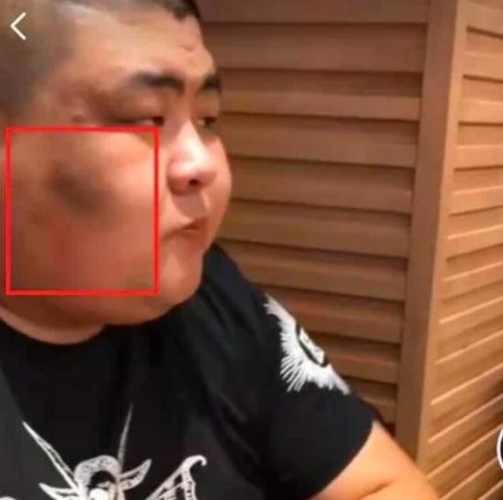 德云社|吃播泡泡龙去世，他生前曾被人强灌花生油？照片曝光后，网友哭了