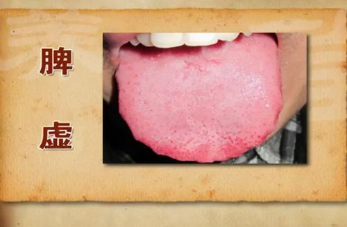 吕中医说 常见六大虚：气虚、脾虚、肾虚、血虚...对应中成药！自查一下，你更适合哪个？