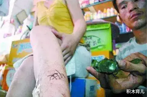 积木育儿|男孩开冰可乐，脸被炸伤缝38针！夏天这些东西放进冰箱就是定时炸弹