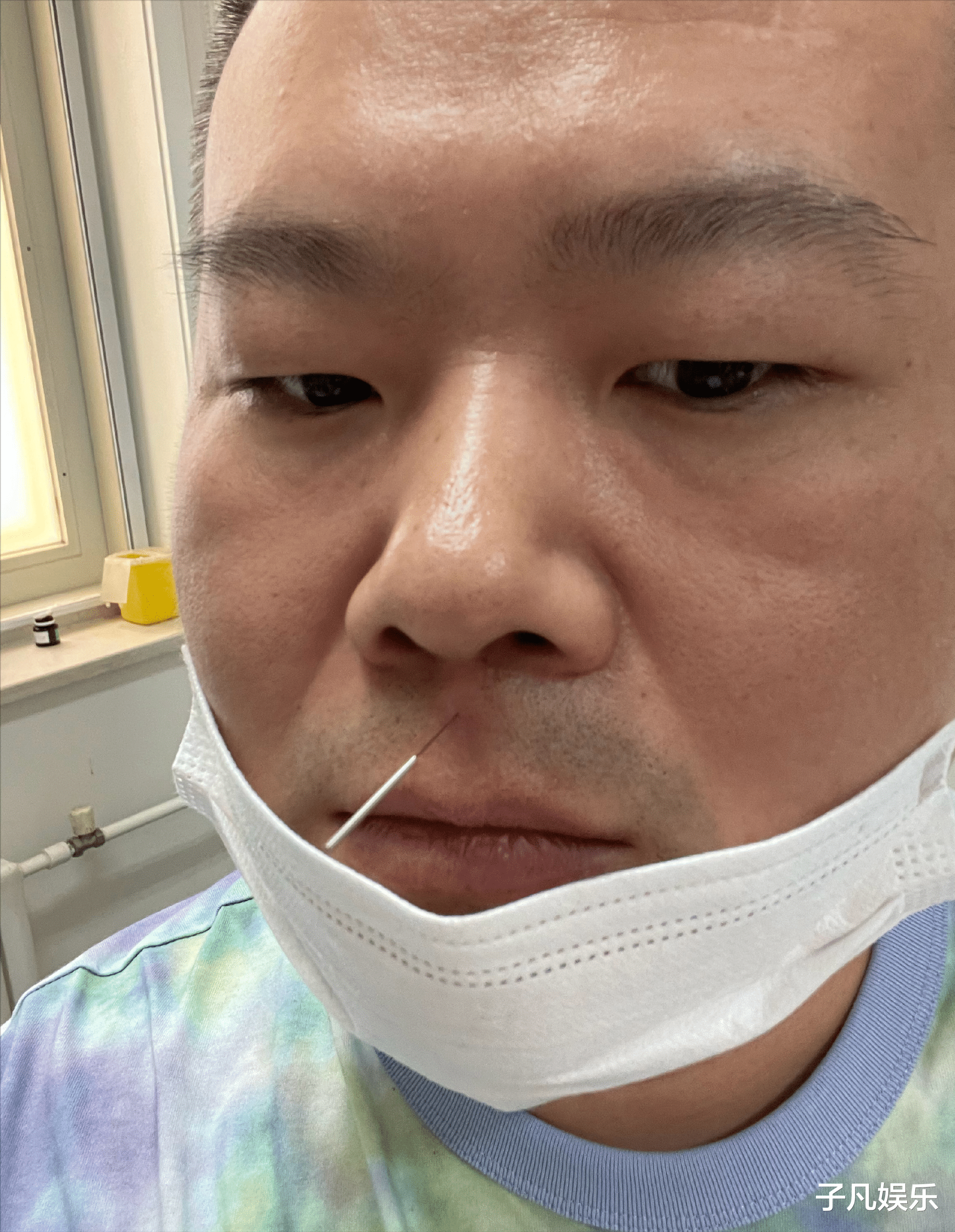 陈亚男|岳云鹏手术已做完，停工后首次露面，回应生病的原因