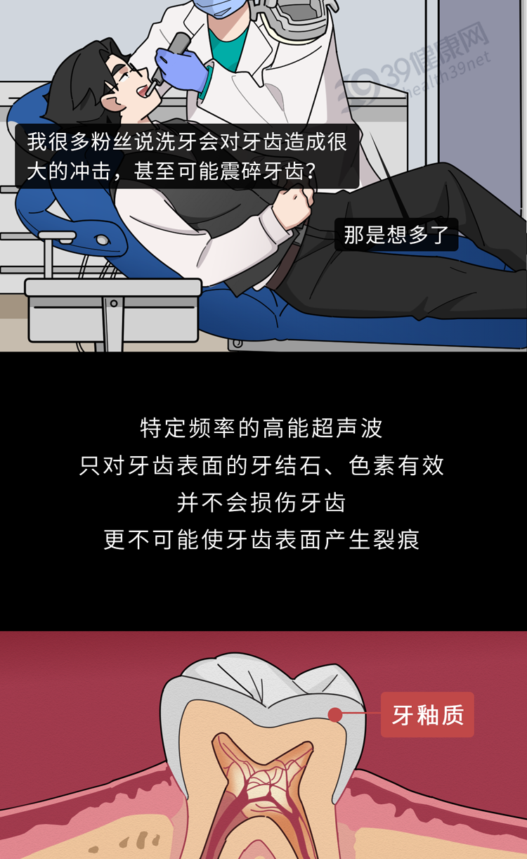 牙齿|不洗牙，你永远不知道牙齿里面有多脏！看完这篇就拿定主意了