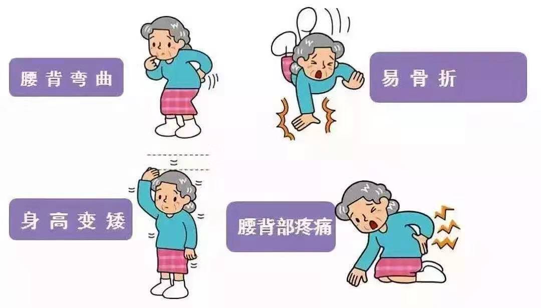 医学小栈|女性到了更年期，牢记3种食物，大胆多吃，远离腰背疼痛
