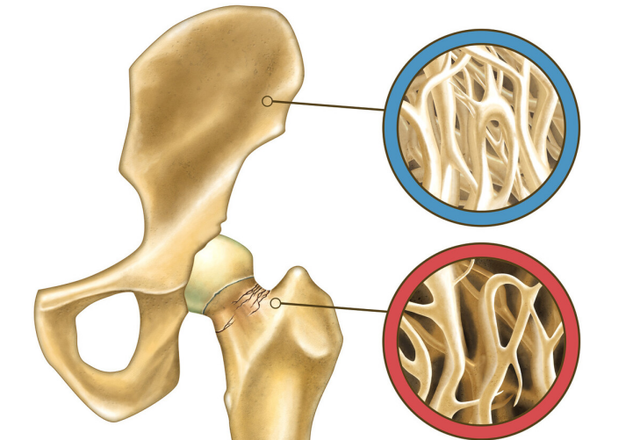 众益康|52岁大叔，坚持每天吃“六味地黄丸”，后来身体怎么样了？