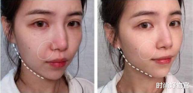 时尚好物官|为变美打“美容针”真的值得么？过来人说出心里话，得不偿失