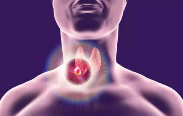 睡眠|体内有“结节”的人，5种“发物”平时尽量少吃，忍住不吃就算赢