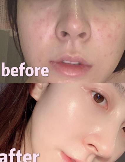 美容 45岁的她天生丽质无需美容，大方分享护肤，自用纯露也因此走红