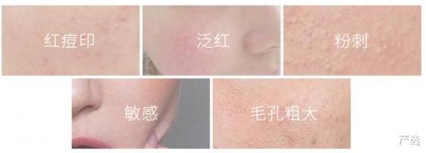 严选|李佳琦晒的驻颜精华，价格便宜不输大牌，张嘉倪：能抗氧化缓衰老