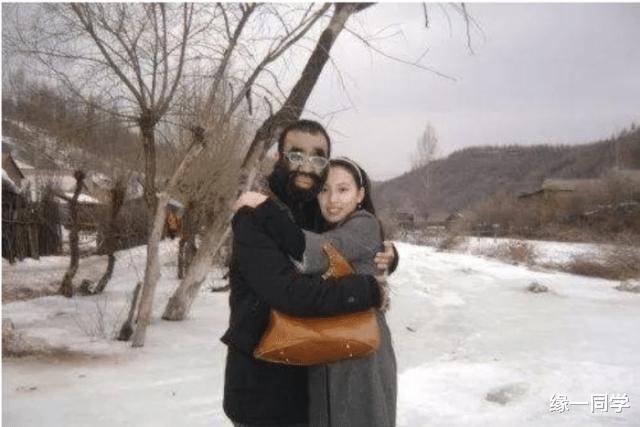 缘一同学 当年轰动全国的“中国第一毛孩”，被人当成怪物，后来怎样了？