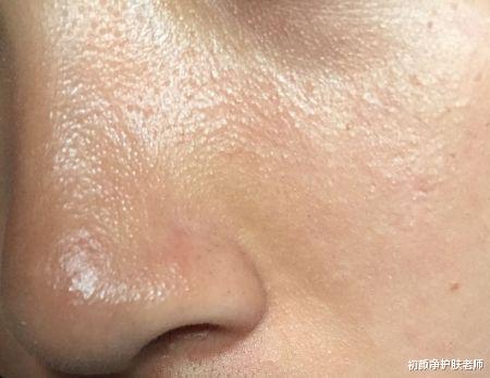 初颜净护肤老师 熬夜对皮肤的伤害有多大!你知道吗?