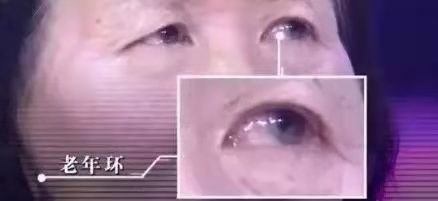 面相|不论男女,出现6种面相,或是疾病或癌的预兆,别以为是“福相”