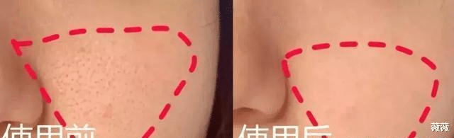 痘痘 李佳琦新推荐“神皂”卖爆了！肌肤问题不用愁，洗出“高颜值”！