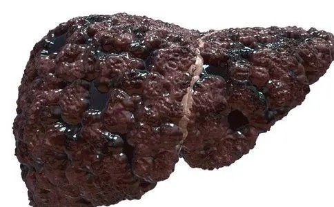 金兰中医学社|肝病“天敌”找到了，并非榴莲，平时敞开吃，肝毒慢慢排出，肝脏白净如初