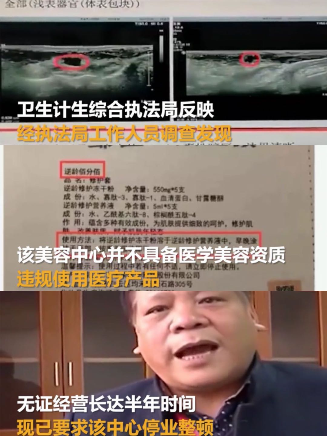 好物官|为抗老去美容院注射“逆龄修复液”的胡女士,如今怎样?事与愿违