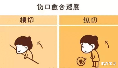 哈啰宝贝|横切漂亮,竖切易恢复,剖腹产能自己选吗?医生:考虑重点不在这