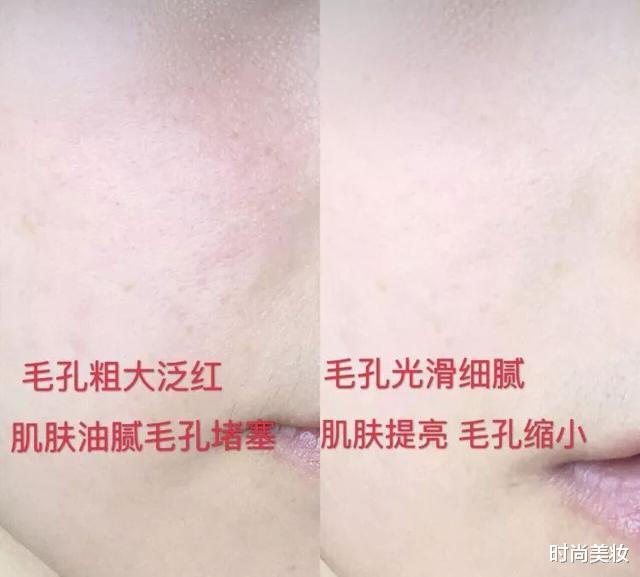 luna|吴昕皮肤光滑白皙，坚持每天用它洗脸，3次就能“震”毛孔垃圾
