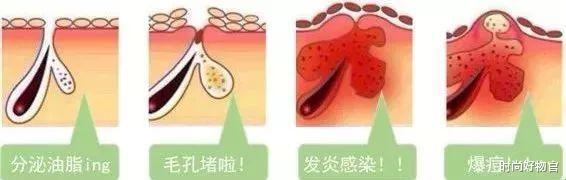 杨超越|43岁大S护肤方式升级后，被人认成00后，为变美“灼烧”皮肤