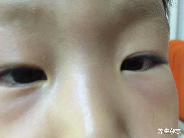 心脏|脾虚积食爱生病,张仲景仅用5味药材,从根部消灭积食,流传千年,简单有效