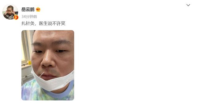 |岳云鹏扎针灸在人中引爆笑，一脸冷漠不敢动，胡子拉碴嘴唇干燥