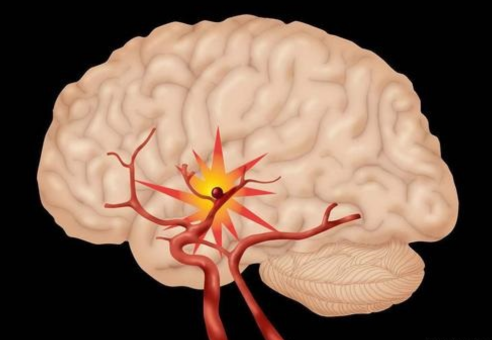 中国科学院 一个特殊病例：在死后10分钟还检测到大脑活动？死后真有生命吗？