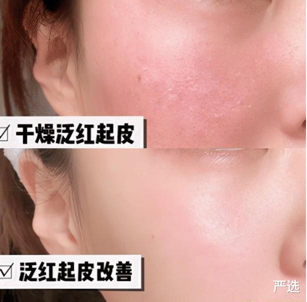 护肤品 建议婚后女人：护肤一定要用这两款产品，肌肤细腻光滑显年轻
