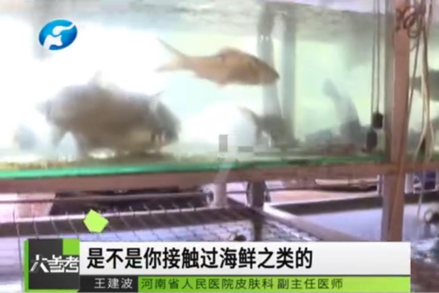 中风|女子被鱼刺扎破后浑身长满疙瘩