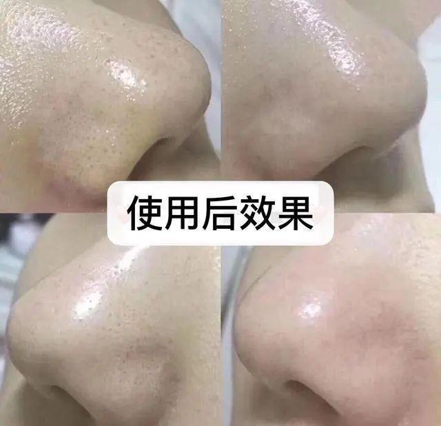 t恤 长期清水洗脸和洗面奶洗脸，皮肤“差距”会有多大？看后恍然大悟