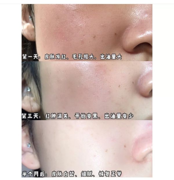 美容养颜 秋冬季，涂身体乳和不涂的差别竟然这么大！