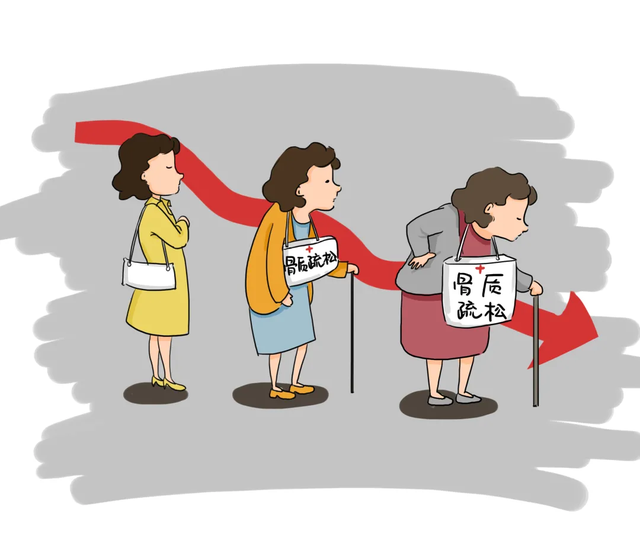同济大学附属天佑医院 天天补钙还是出现骨质疏松？关于骨质疏松的几大误区你中了吗？