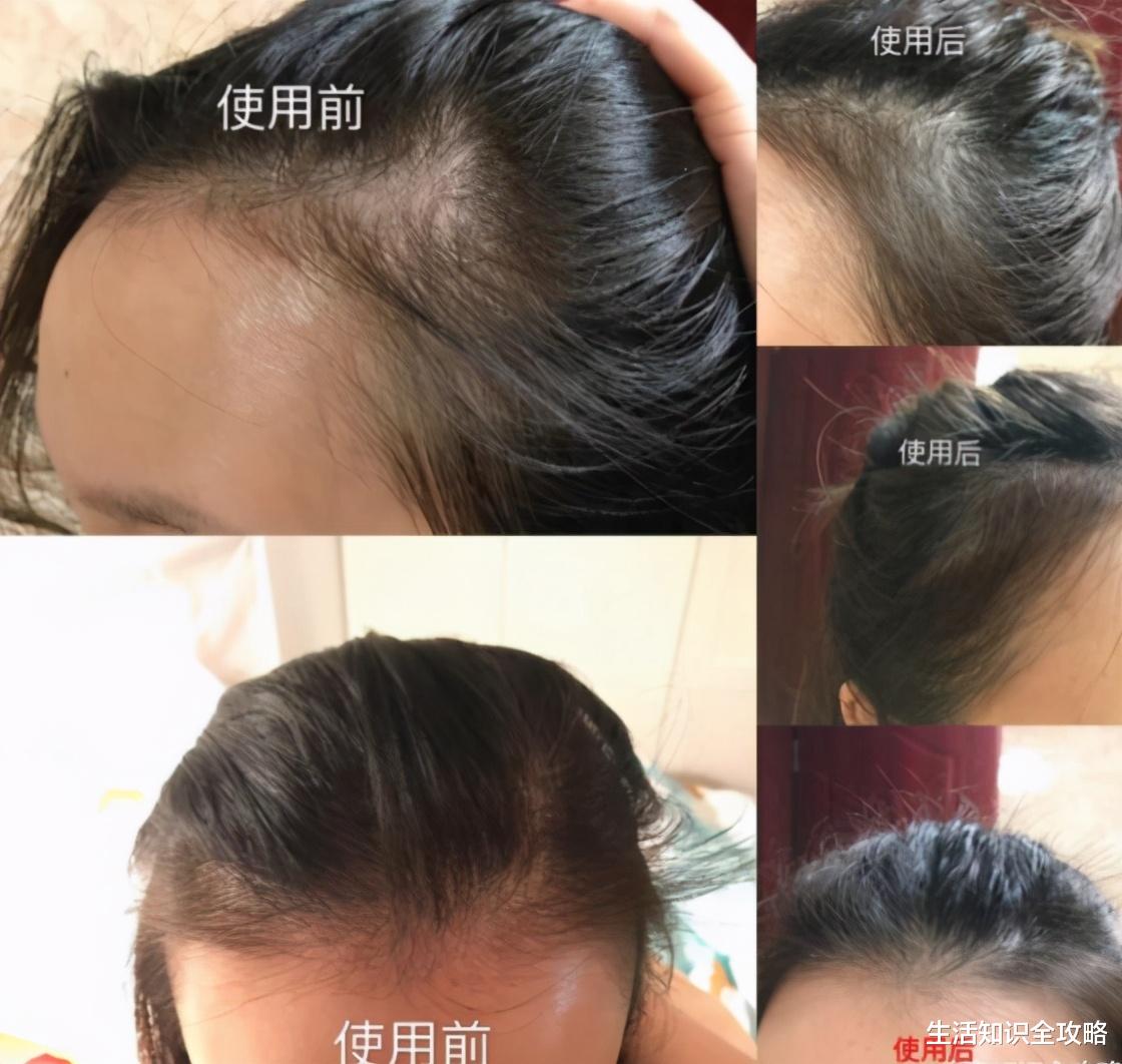 妇科疾病|曝光列入黑名单的“致癌”洗发水，专家提醒：家里有的赶紧丢了！