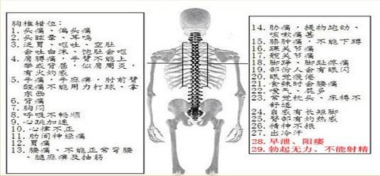 邱氏悬壶 腰椎间盘突出会引起的阳痿吗！邱氏悬壶