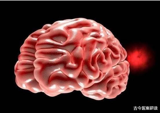 古今医案研读|手脚是健康的“晴雨表”，手脚上若有这4种表现，当心脑梗找上自己