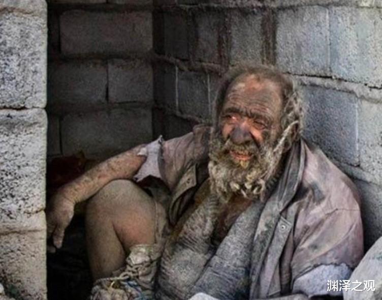 吉尼斯世界纪录 老人因60年不洗澡打破吉尼斯纪录，身体就像裹了铠甲，是何原因？